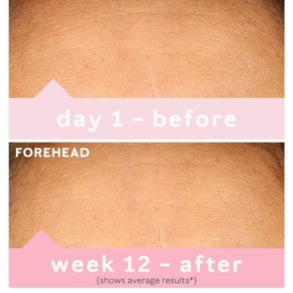 Mary kay New Timewise Miracle set - Combo to Oily Skin. - Picture 5 of 5